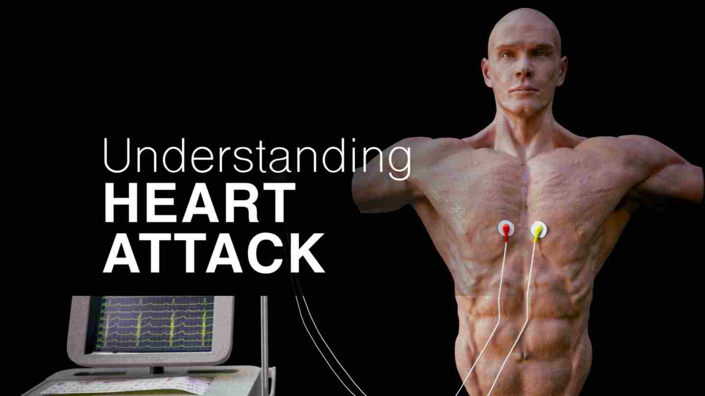 了解心脏病 - Understanding Heart Attack
