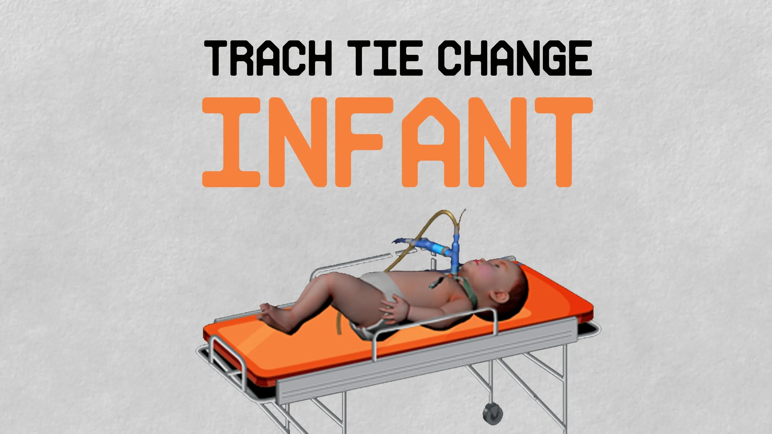 气管切开固定带更换 - Trach Tie Change – Infant